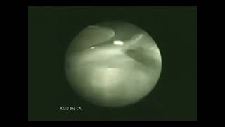 Endoscopie Dune Combustion Réelle Dun Moteur Thermique