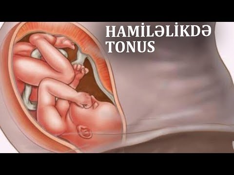 Hamiləlikdə tonus - Hansı halda təhlükəlidir?