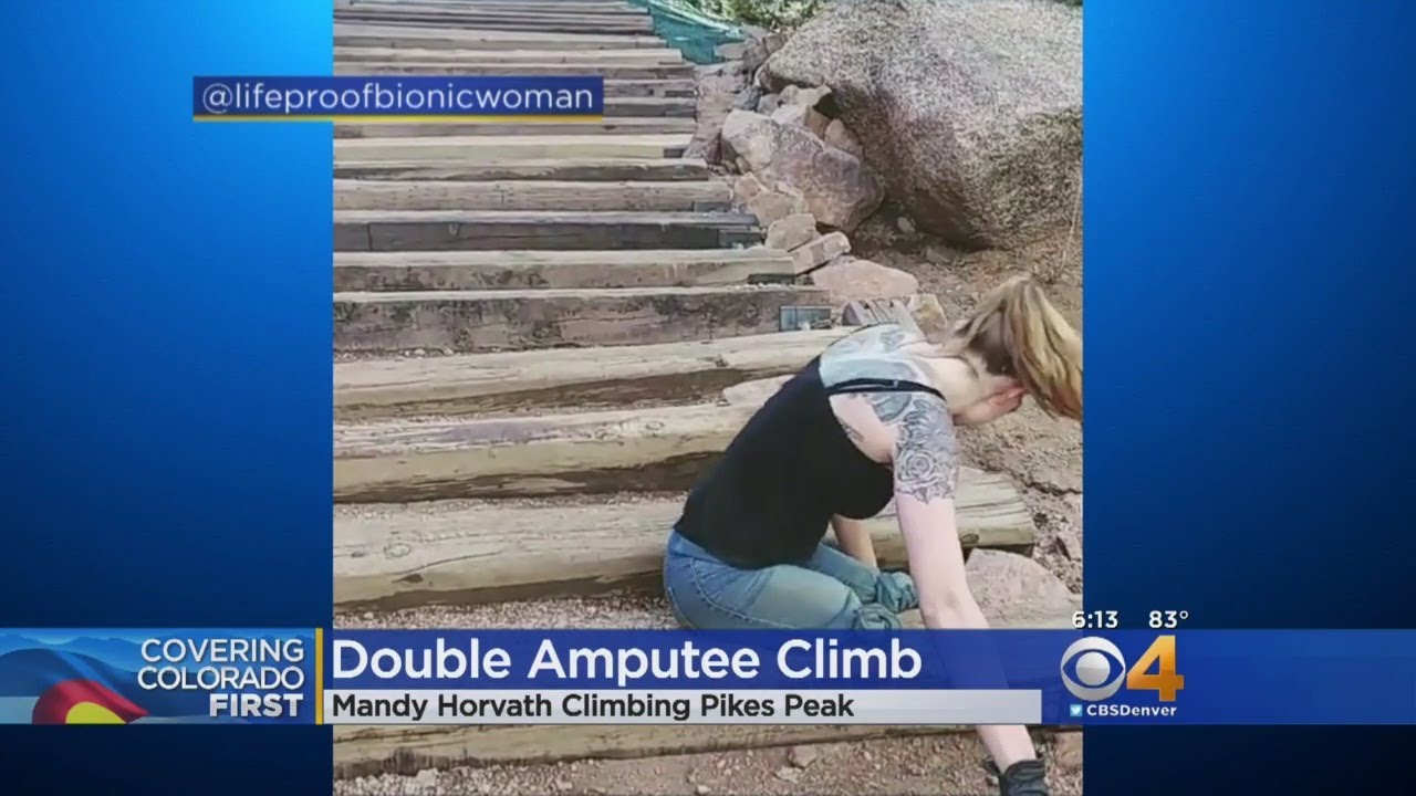 Double Amputee Sets Out On Another Amazing Feat
