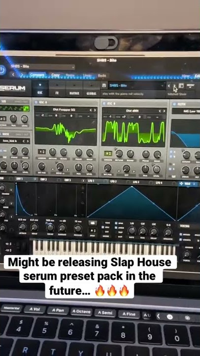 Slap House Serum preset pack!! (unreleased)