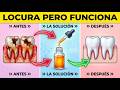 Olvida el enjuague bucal — Este aceite mata las bacterias dañinas de las ENCÍAS