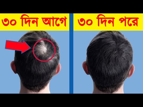 চুল পড়া বন্ধ করে নতুন চুল গজানোর কার্যকরী উপায় | Homemade Garlic Hair Oil for Double Hair Growth