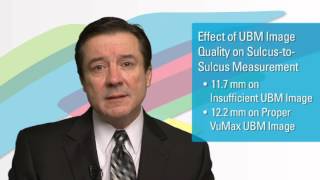 Preventing Risk of ICL Explantation Using Accurate UBM Measurements by Robert Rivera, MD