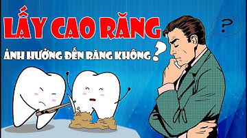 Lấy Cao Răng Có Ảnh Hưởng Gì Đến Răng Không?