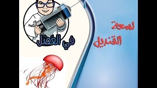 في العضل | لسعة القنديل