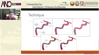 03 Santiago Ortega Gutierrez  Endovascular Therapy for Acute Ischemic stroke  Beyond the guidelines