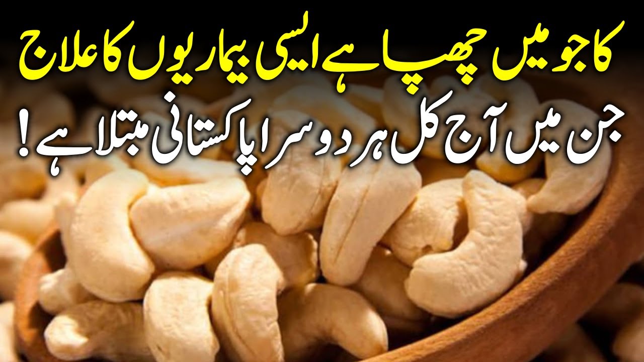 Benefits Of Cashew Kaju K Fayde Urdu Hindi YouTube