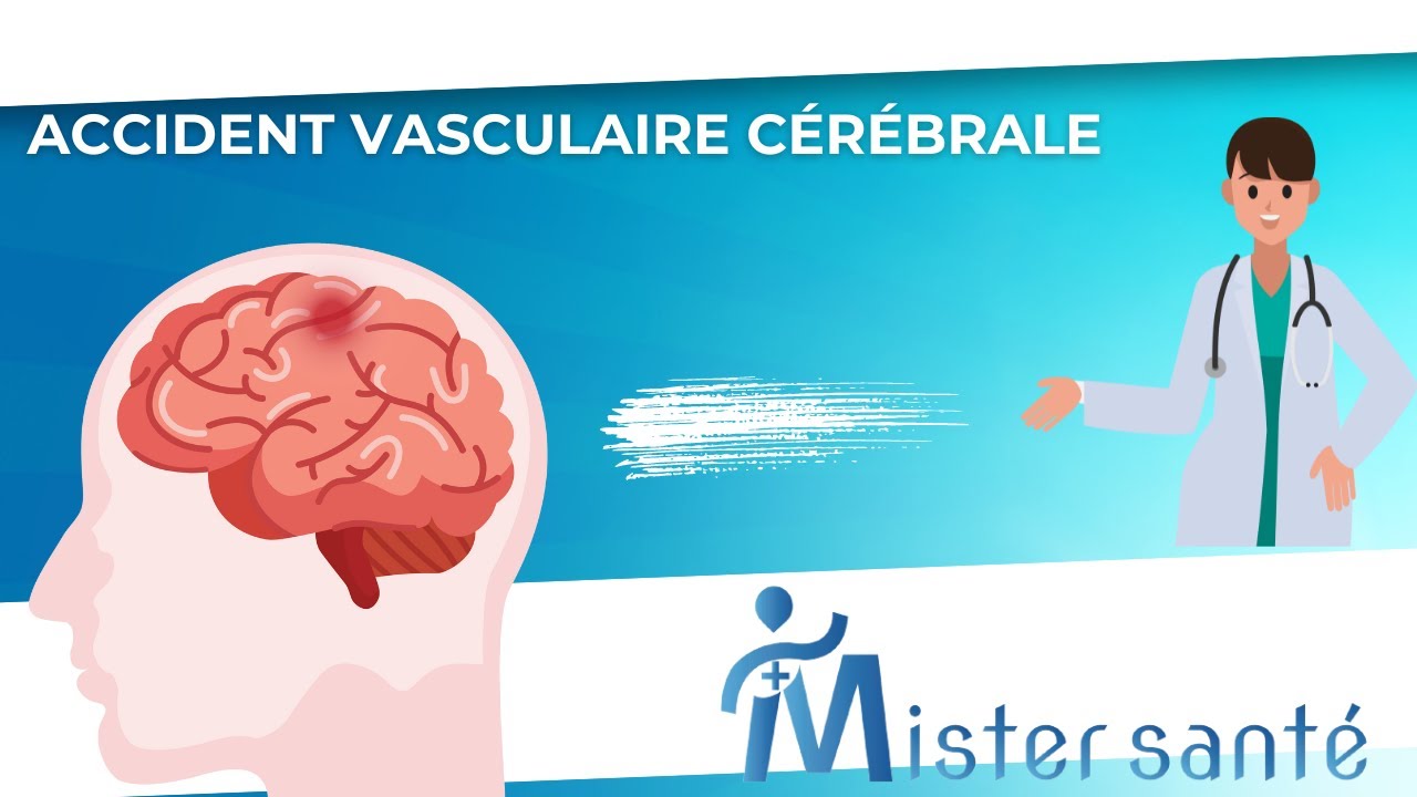 Accident Vasculaire Cérébral (AVC) : 10 Symptômes à ne Pas Ignorer
