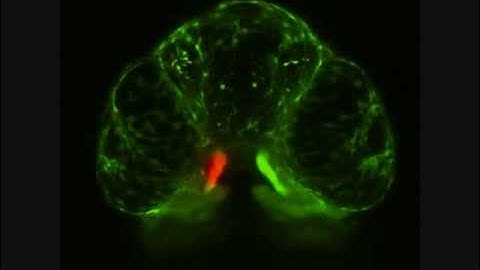Cranial neural crest cell migration in the Tg:sox10::kaede transgenic, wildtype, approx 48-54 hpf
