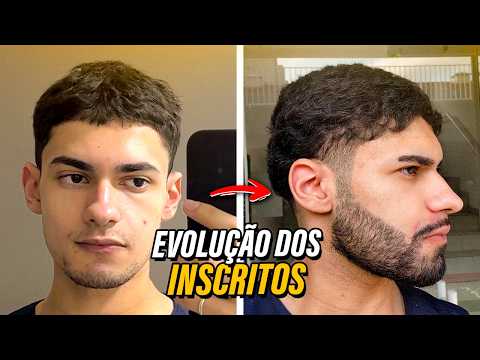 MINOXIDIL - ANTES x DEPOIS dos INSCRITOS. Eles resolveram se cuidar!