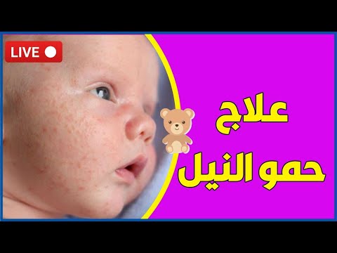 فيديو: كيفية علاج حساسية الأطفال حديثي الولادة