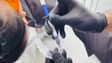 How to Perform an IPR and fix the attachments with Pearl Aligners