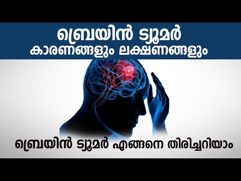 ബ്രെയിൻ ട്യൂമർ ലക്ഷണങ്ങളും കാരണങ്ങളും | Brain Tumor Symptoms and Causes Malayalam