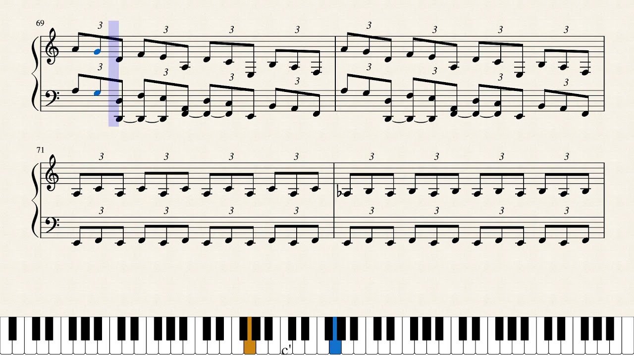 Matthew Phillips - Audra