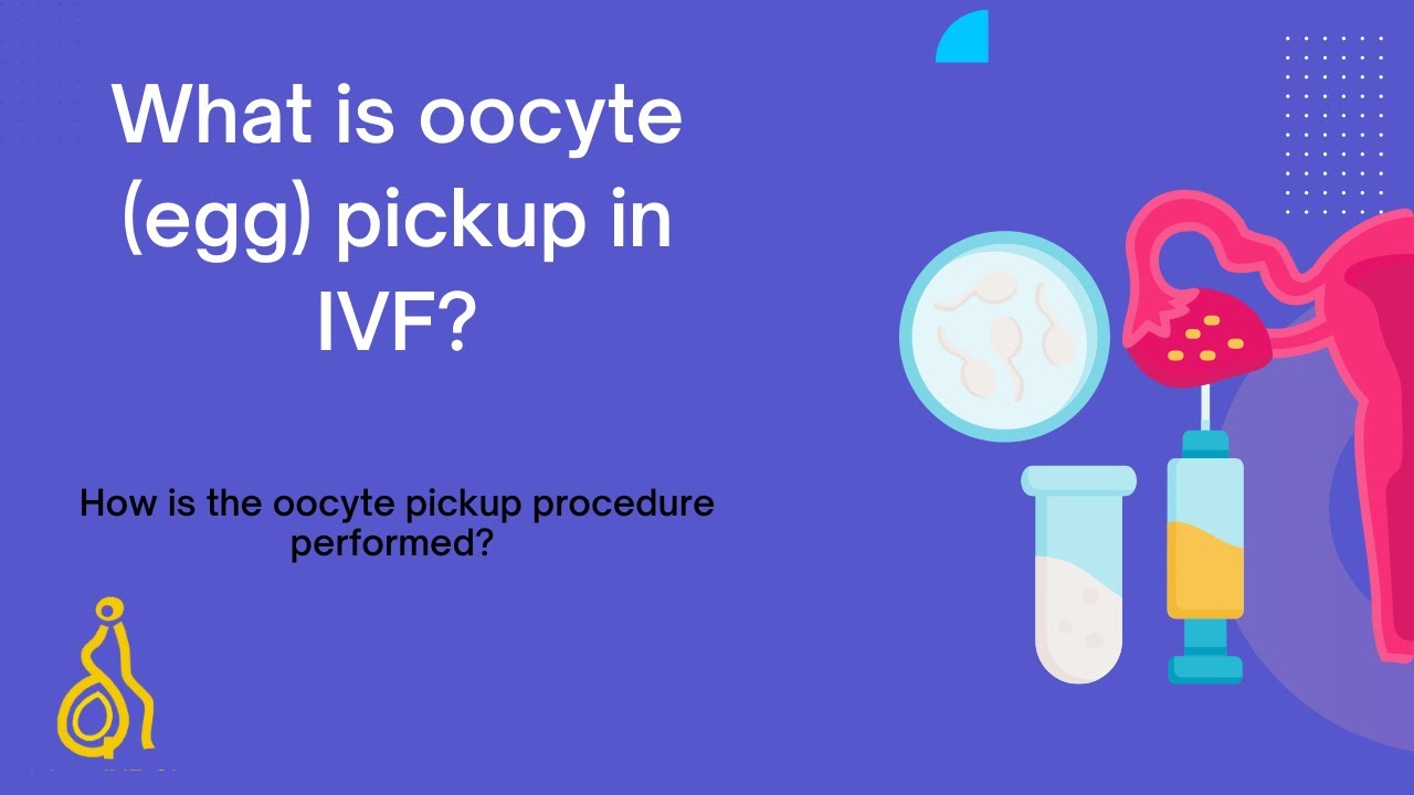 What is oocyte (egg) pickup in IVF? | Dr.RamaRaju || Krishna IVF Clinic ||