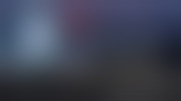 Non-edited, Reduced-port Robotic Distal Gastrectomy with D2 dissection and Roux-en -Y anastomosis