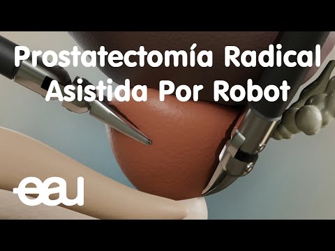 Prostatectomía Radical Asistida Por Robot