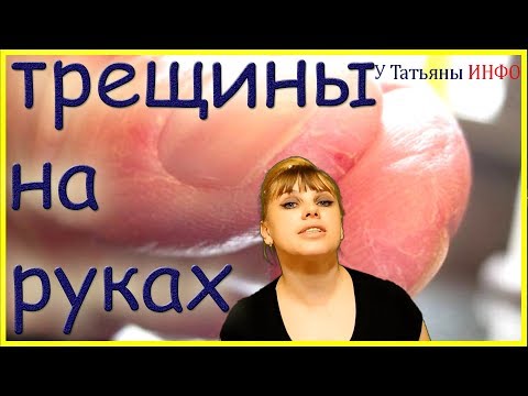 У Вас трескается КОЖА на руках и ногах - тогда мы идем к Вам!!!