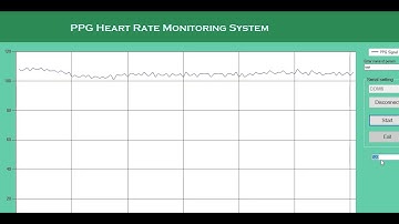 FINAL YAR PROJECT IDEAS -ESP32 BASED HEART BEAT MONITORING SYTEM -PPG SIGNAL FINDER -ME PROJECT