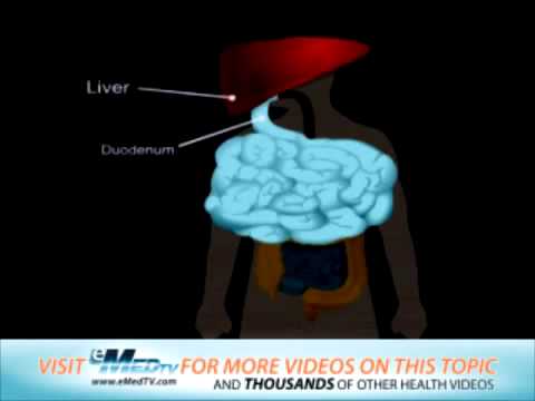 diabetes hoher blutzucker síntomas de cáncer de páncreas