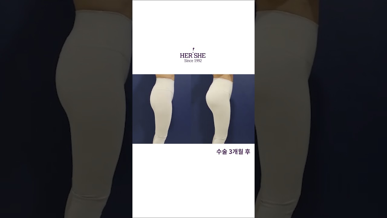 [Херши гоо сайхны эмнэлэг] Өгзөг өргөх лифтинг#shorts #өгзөг_өргөх #өгзөг_өргөх_мэс_засал #ташааны_хонхорхой