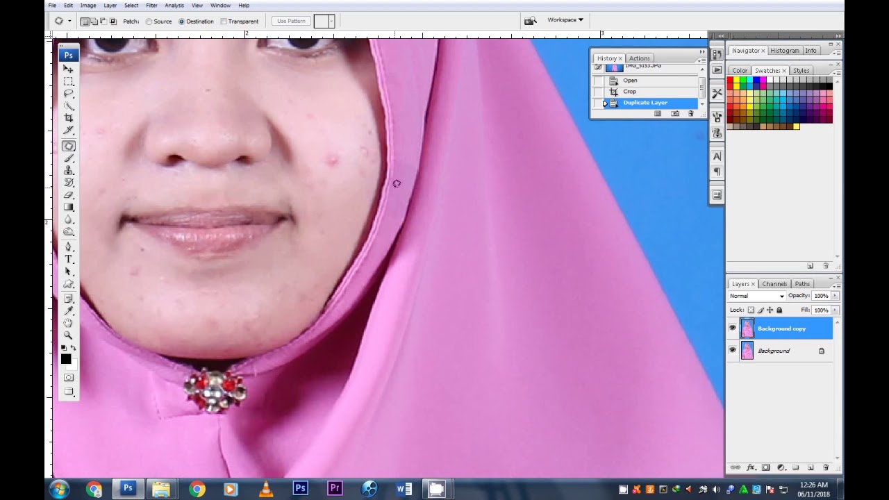cara menghilangkan jerawat dengan mudah pada photoshop 