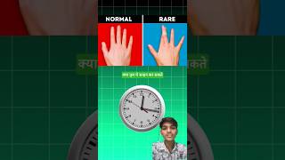 Whois Rare Vs Normal