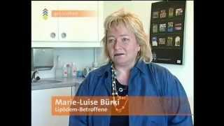 Dr. Linde - was ist ein Lipödem