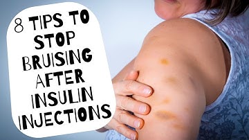8 Tips to Stop Bruising After Insulin Injections