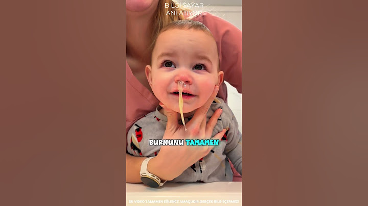 Burnundan ÇIKANA Bakın! 👃😲