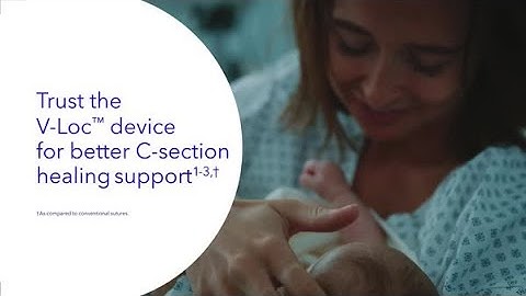 The V-Loc™ wound closure device in C-section