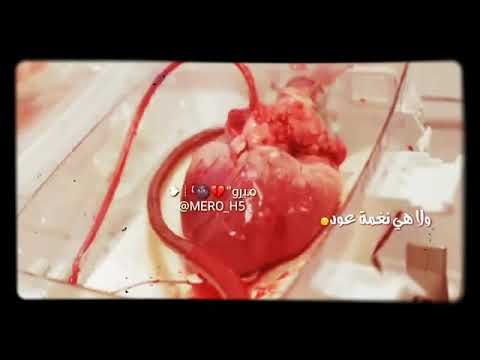 حالات واتسب هي نخزت جرح أم هي نغمت تعود