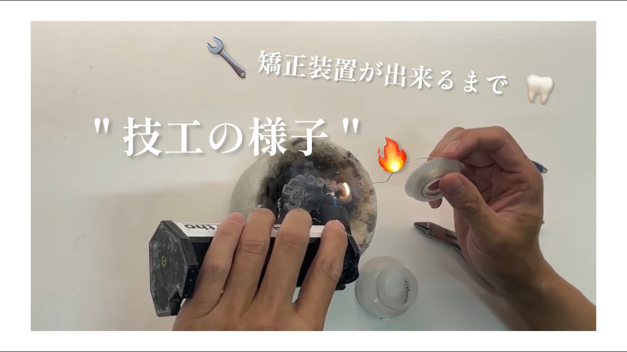 【歯列矯正🦷】教科書には載っていない！②装着技工の様子🤫🔧（パラタルバー）