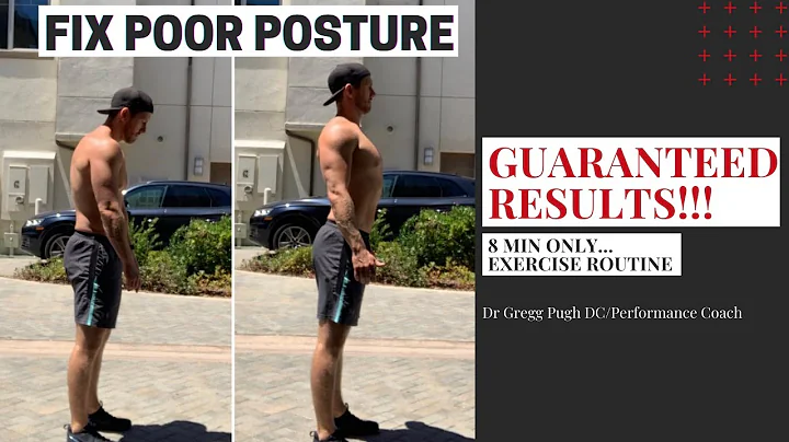 How to fix poor posture  - Do this 8 min plan dail...