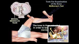 Tests For Examination Of The Knee  Everything You Need To Know  Dr. Nabil Ebraheim
