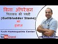 पित्ताशय की पथरी (Gallbladder Stone) का बिना ऑपरेशन के इलाज | Yash Homeopathic Center