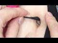 【衝撃】美少女のへそ掃除をしたら魔物が出てきた【グロ注意】navel stone from a dirty bellybutton