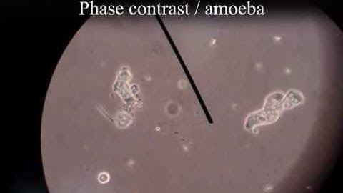 Darkfield & Phase contrast video