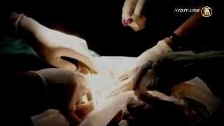 【禁聞】臓器狩りを裏付ける22の録音テープ20150409