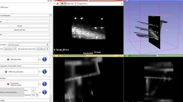 Real-time volume reconstruction using a motorized ultrasound probe