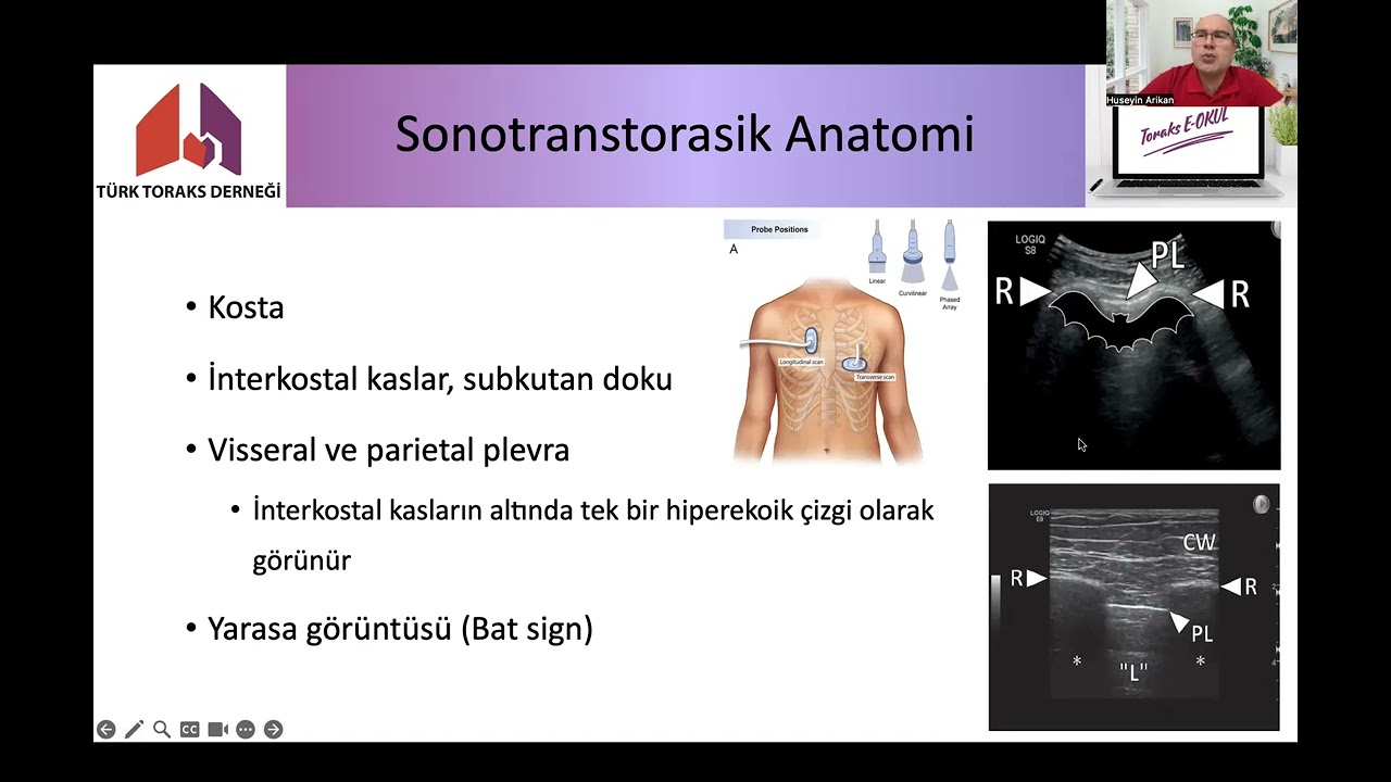 Toraks Ultrasonografide Temel Kavramlar   Dr  Hüseyin Arıkan (Sağlık Profesyonelleri içindir)