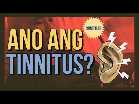 Video: Ano ang tunog ng isang masamang sinturon na serpentine?