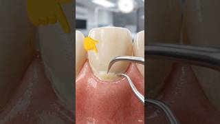 Dental AI Video Kaise Banaye? 🦷 | AI Teeth Transformation Video Tutorial#DentalAI #AIVideo