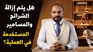 عملية ازالة الشرائح والمسامير | د.محمد عبدالرازق