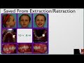 Can Your Child Be Saved From Extraction Retraction?