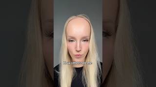 Celebrity How other see me vs how I see myself. #bigforehead Profile