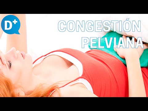 Vídeo: Síndrome De Congestión Pélvica: Síntomas, Tratamientos Y Embarazo