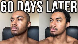 I Tried a Hair Growth Kit for 60 Days... Here's What Happened (ft. Copenhagen Grooming) by Jordan Green 4,416 views 5 months ago 21 minutes