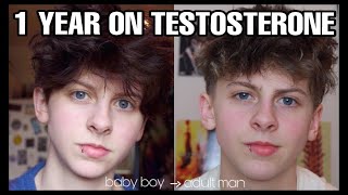 1 YEAR ON TESTOSTERONE (TRANSGENDER FTM) | NOAHFINNCE