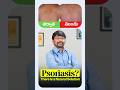 Natural Care for Psoriasis | Sparsa HomeoCare